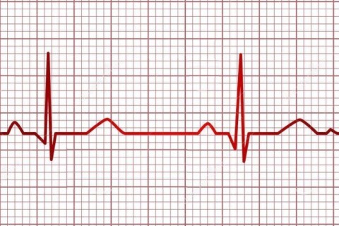 EKG (Electrocardiograma) la domiciliu Bucuresti