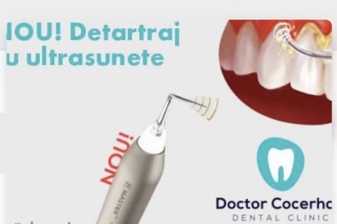 Detartraj fara durere + Periaj profesional!