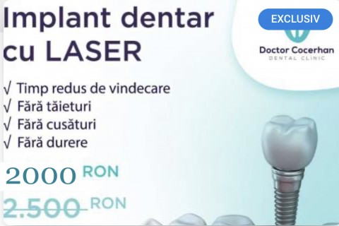 Implant dentar fara operatie sau taieturi!